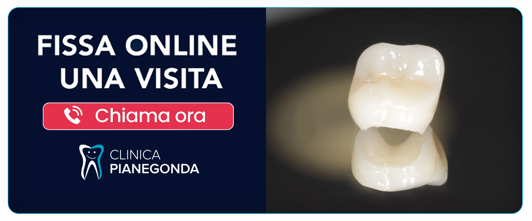 capsule-dentali-metal-free trissino